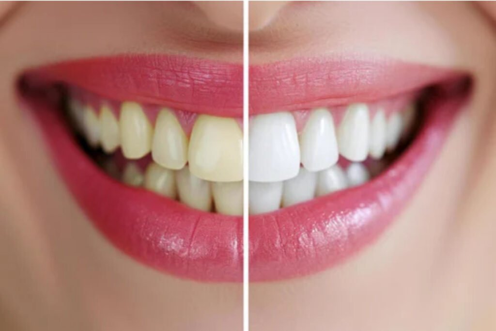 Cosmetic Dentistry