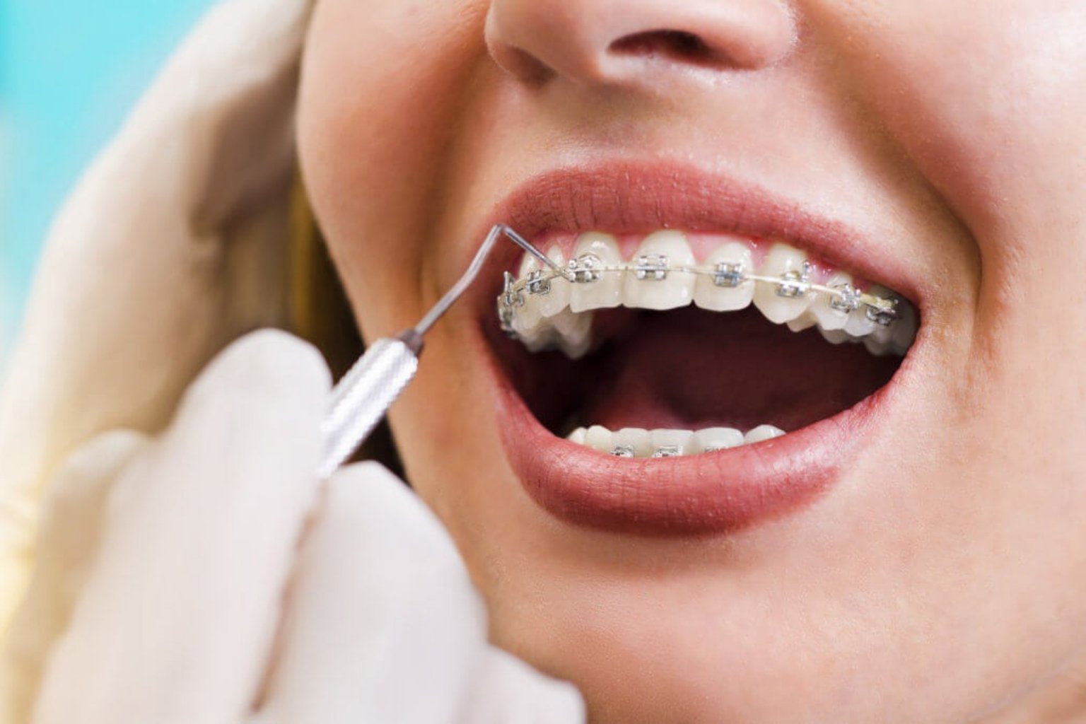 Orthodontics